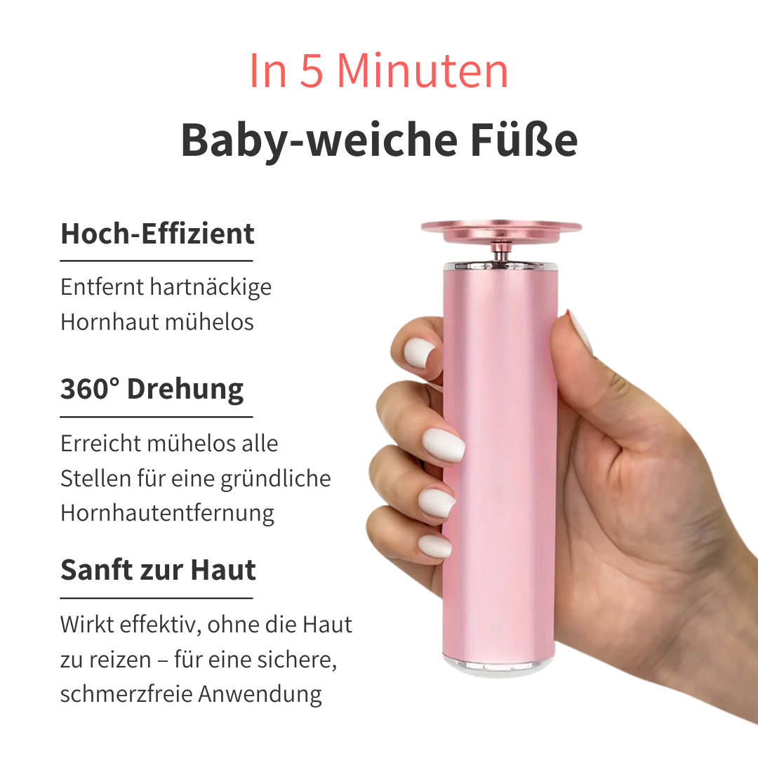 SKNLY™ - Elektrischer Hornhautentferner