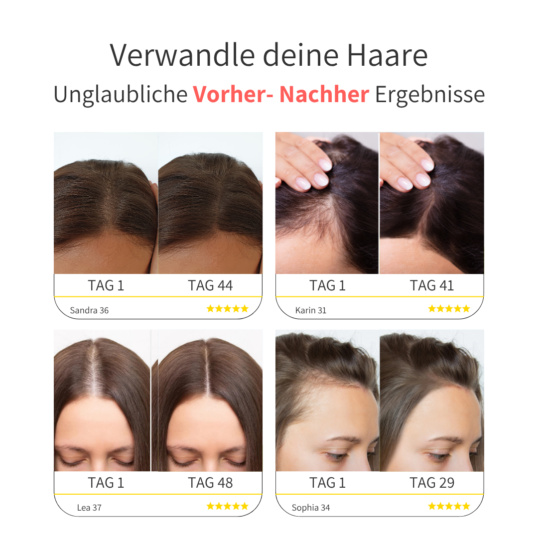SKNLY™ 3in1 Kopfhaut-Massagebürste für kräftiges & volleres Haar