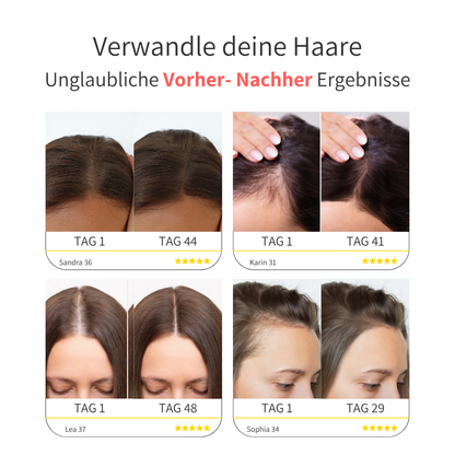 SKNLY™ 3in1 Kopfhaut-Massagebürste für kräftiges & volleres Haar