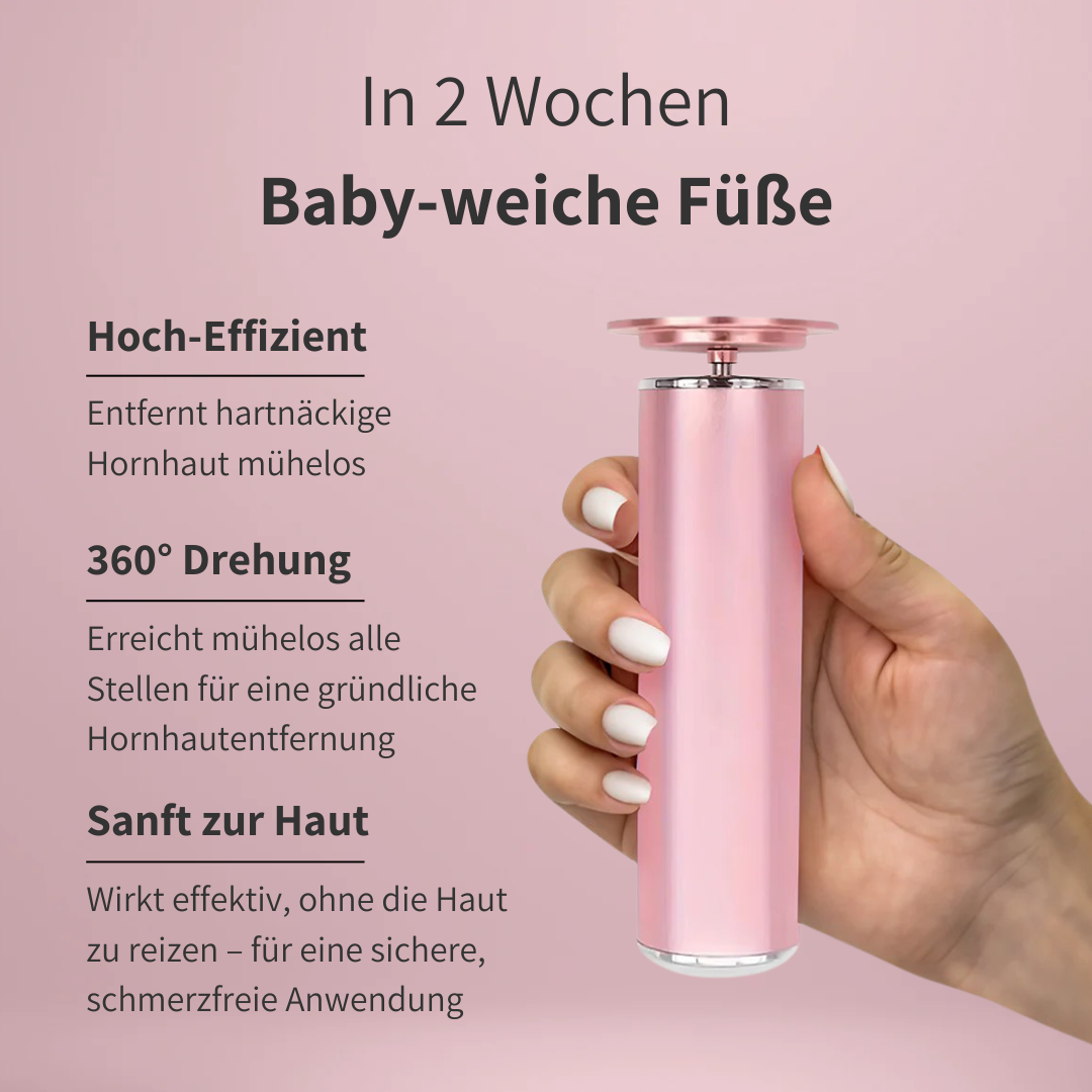 SKNLY™ - Elektrischer Hornhautentferner